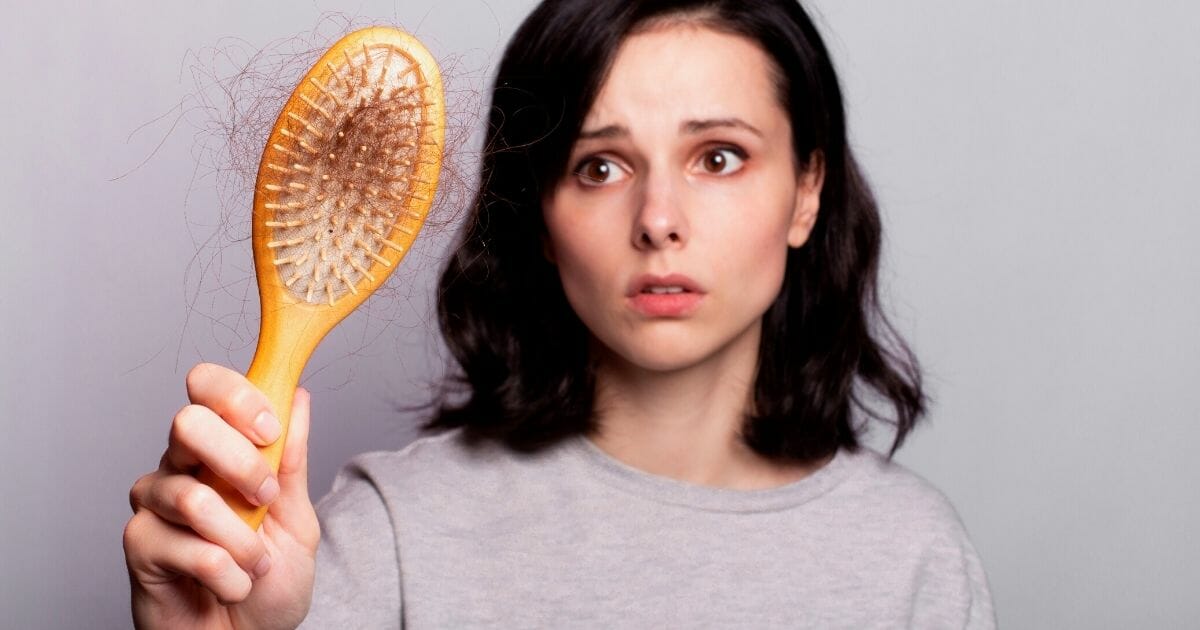 alopecia donne alopecia donne