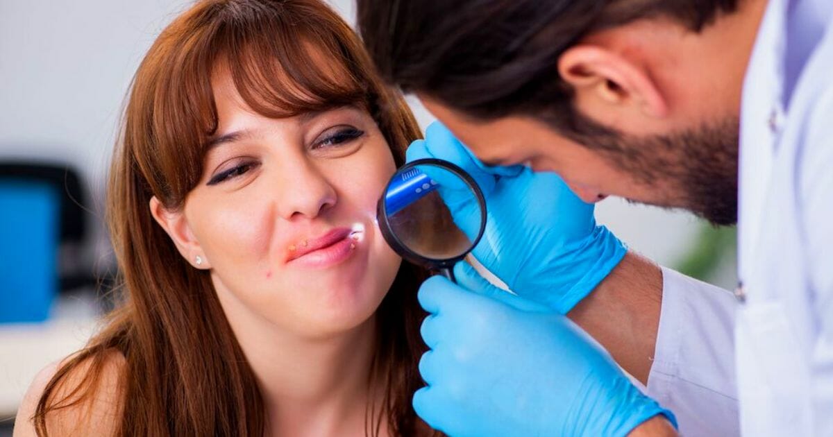 rimedi herpes labiale rimedi herpes labiale