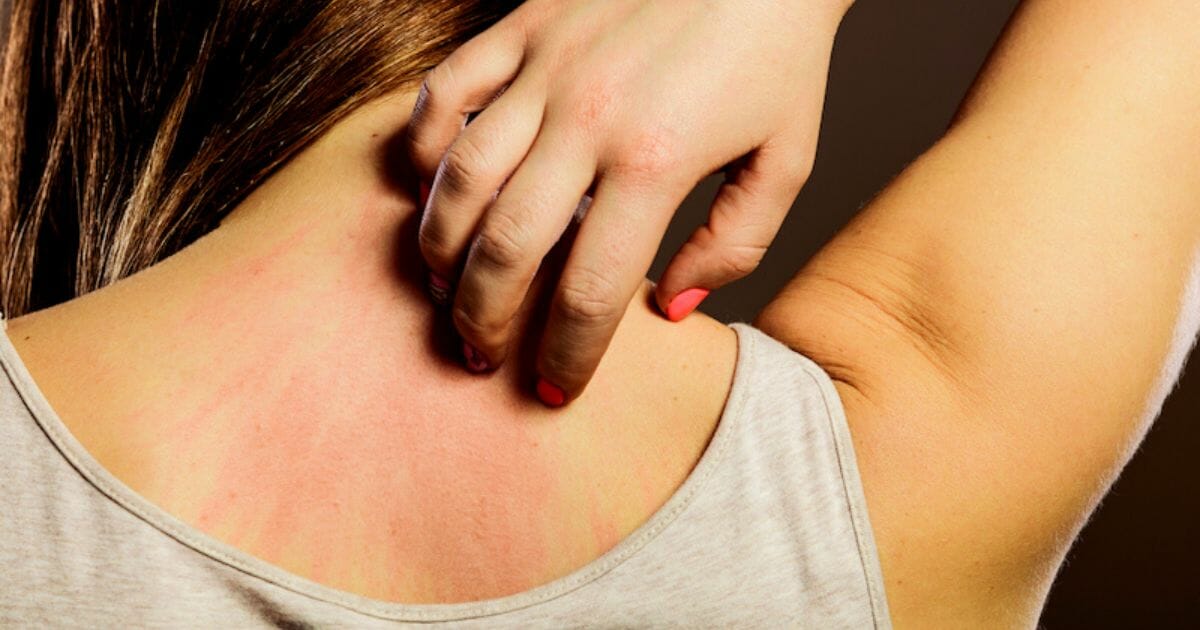 rush cutaneo rush cutaneo