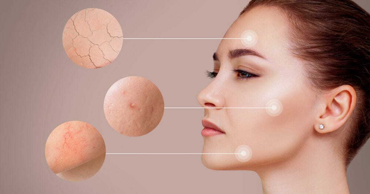 cosa può causare irritazione alla pelle cosa può causare irritazione alla pelle