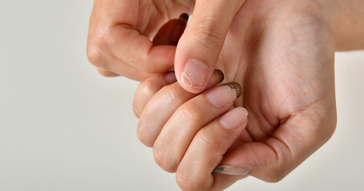 unghie che si spezzano unghie che si spezzano