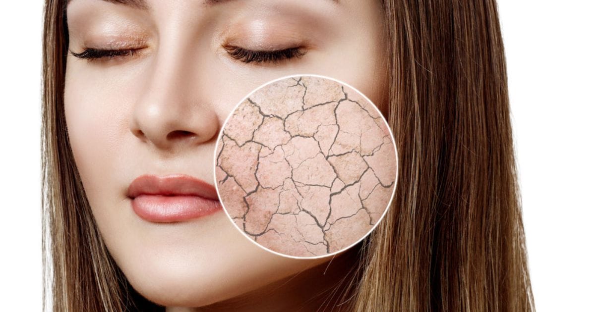 colloidale per la pelle