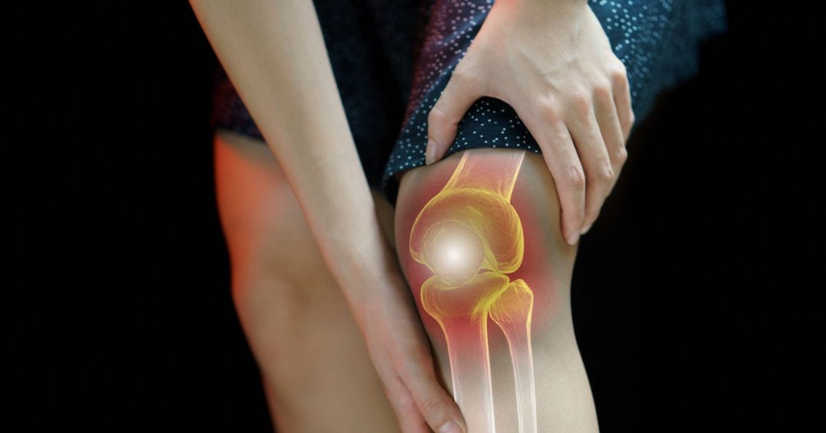 integratori per artrosi